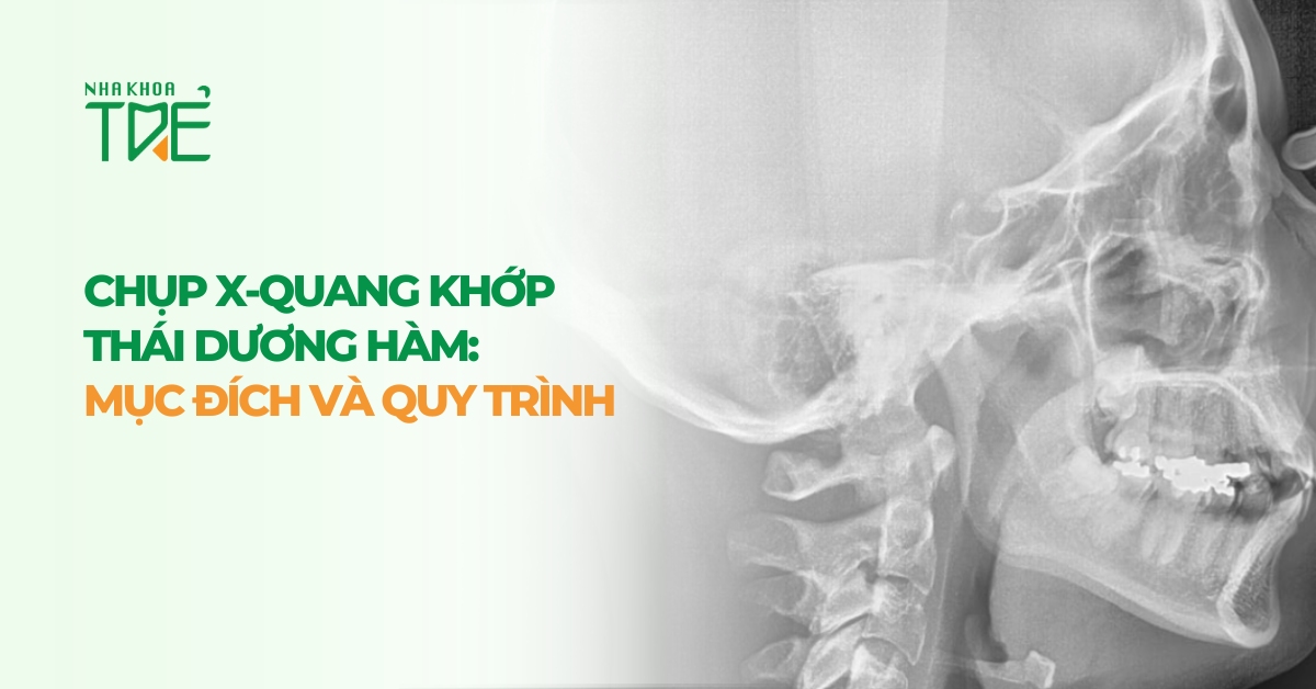 Chụp X-quang khớp thái dương hàm: Mục đích và quy trình