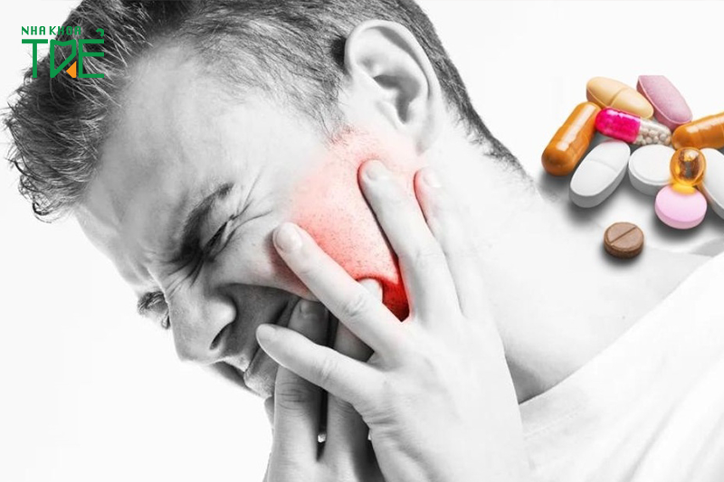 Viêm khớp hàm uống thuốc gì? 4 lưu ý khi dùng thuốc