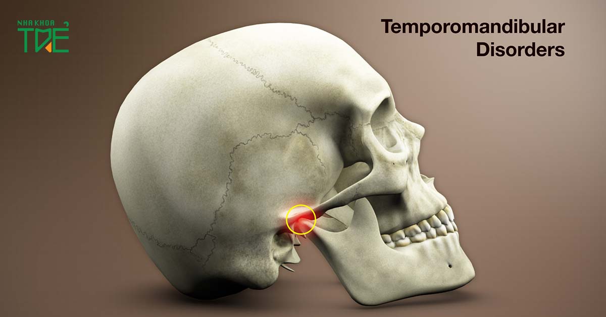 Rối loạn khớp thái dương gây khó khăn khi hoạt động hàm
