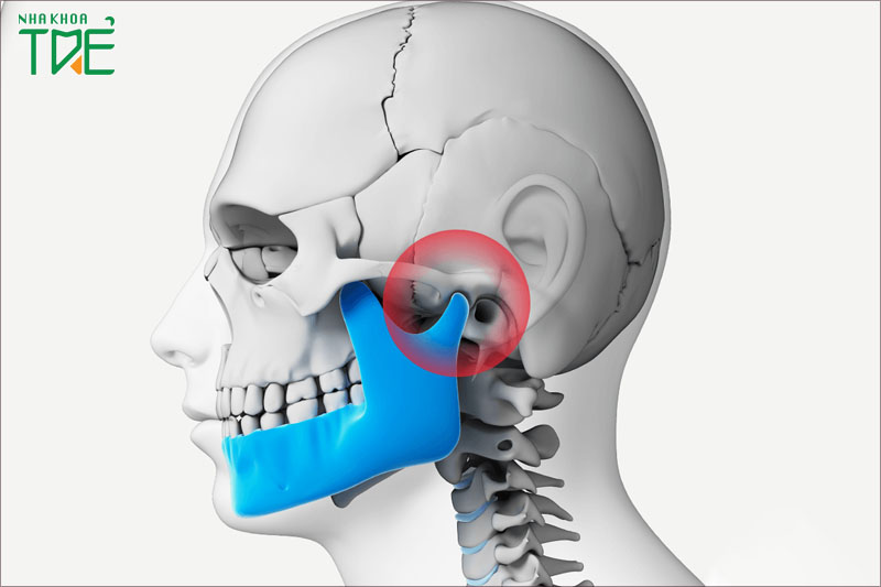 Trật khớp thái dương hàm là gì? 3 cách điều trị phổ biến