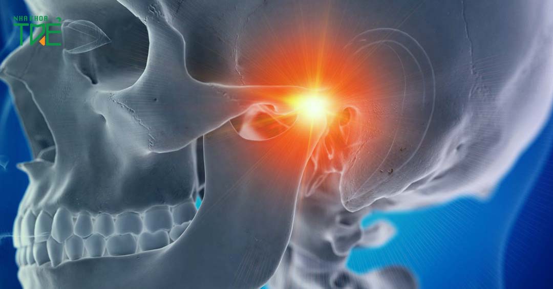 Rối loạn khớp thái dương hàm TMJ: Dấu hiệu, nguyên nhân và cách chữa trị