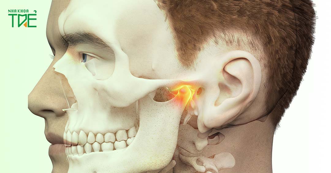 Thoái hóa khớp thái dương hàm: Nguyên nhân, dấu hiệu và cách điều trị