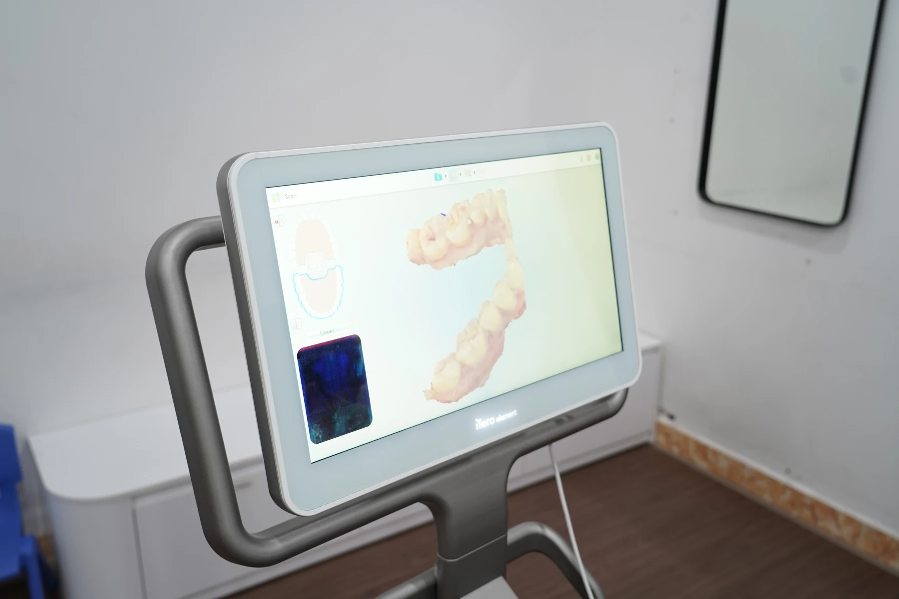 Hệ thống máy scan trong miệng iTero