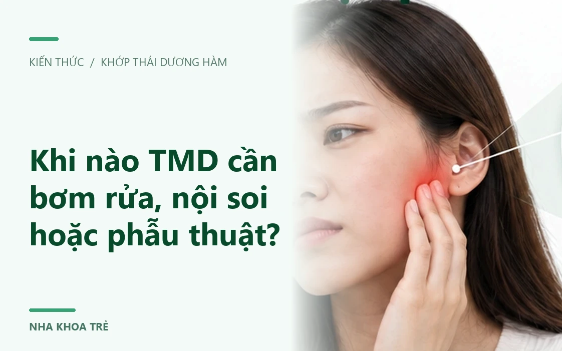 Khi nào TMD cần bơm rửa, nội soi hoặc phẫu thuật?