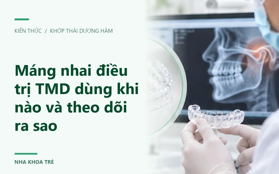 Máng nhai điều trị TMD dùng khi nào và theo dõi ra sao?