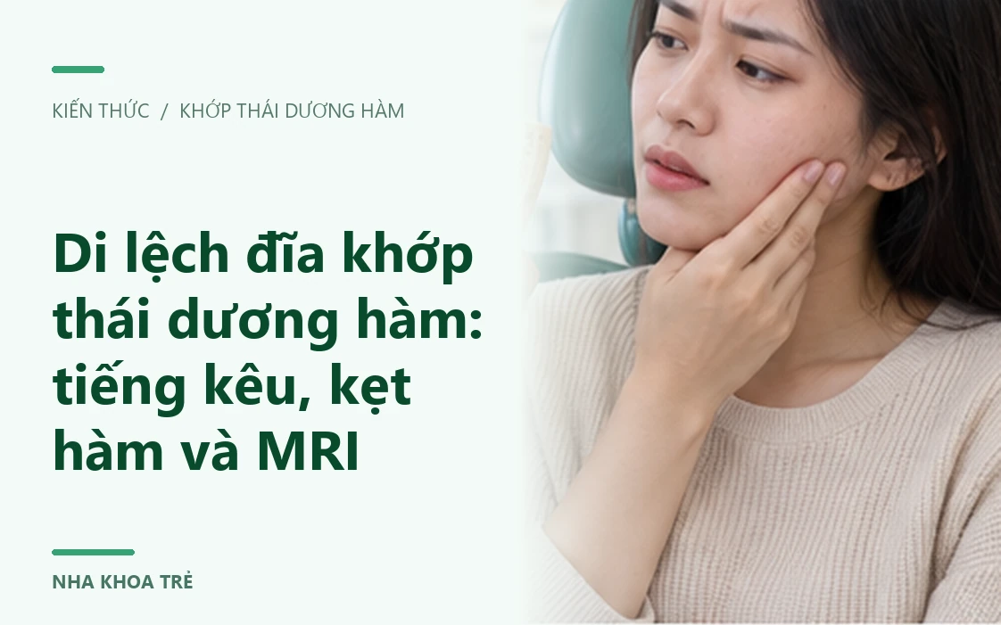 Minh họa triệu chứng khóa hàm cần đánh giá vị trí đĩa khớp