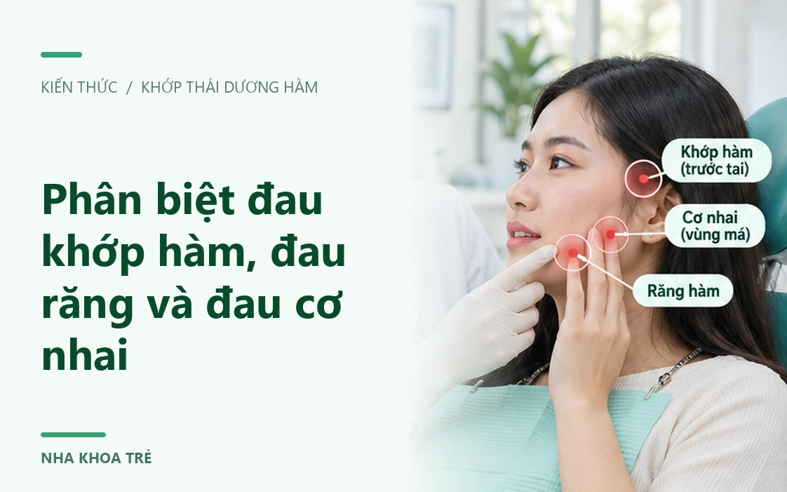 Minh họa đau mỏi cơ nhai vùng má và thái dương