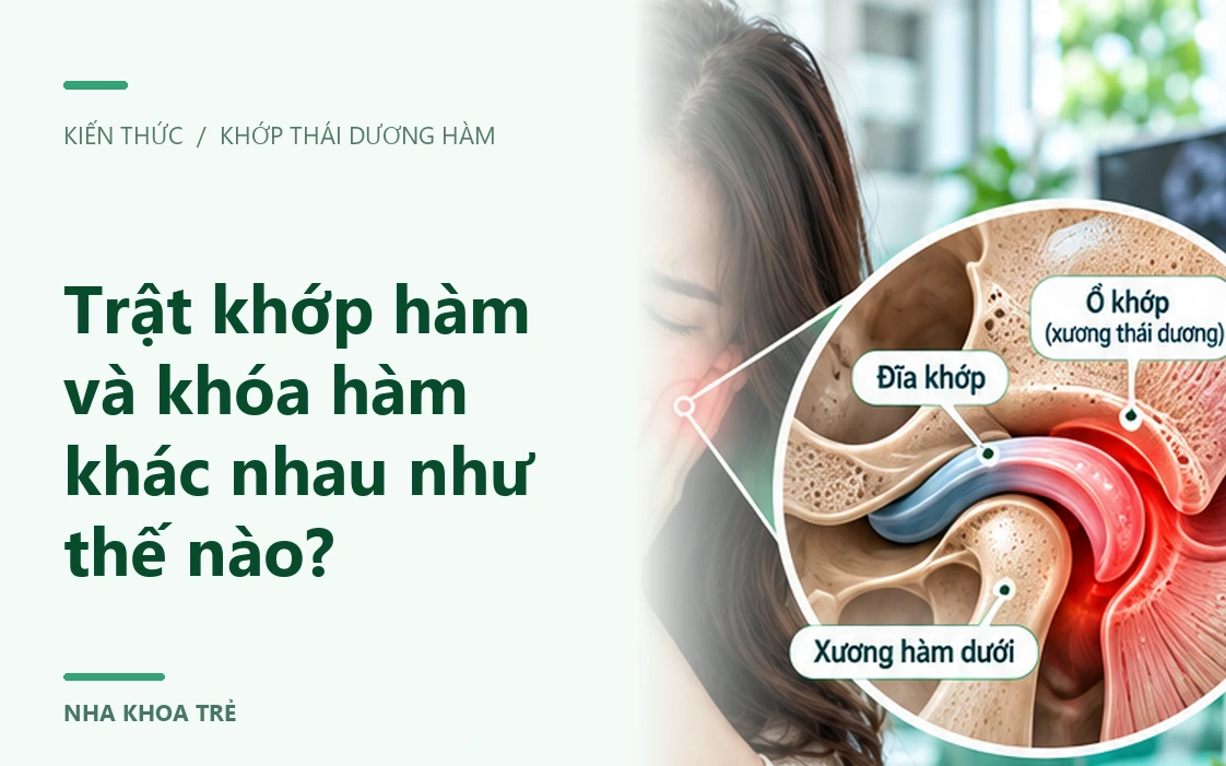 Hình minh họa vùng hàm, cơ nhai và khớp thái dương hàm