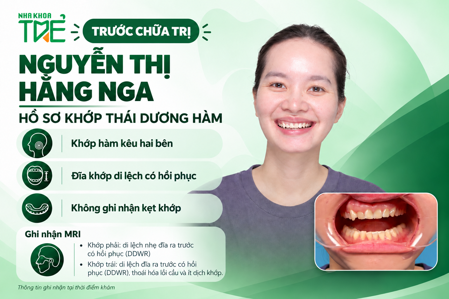 Nguyễn Thị Hằng Nga trước chữa trị và tóm tắt hồ sơ khớp thái dương hàm